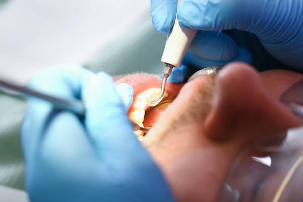 Best Pediatric Emergency Dentist in Central Square, NY